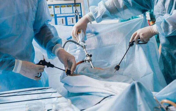 Cirurgia Ginecológica Minimamente Invasiva Histeroscopia e Laparoscopia Ginecológica Dra. Camila Bonacordi
